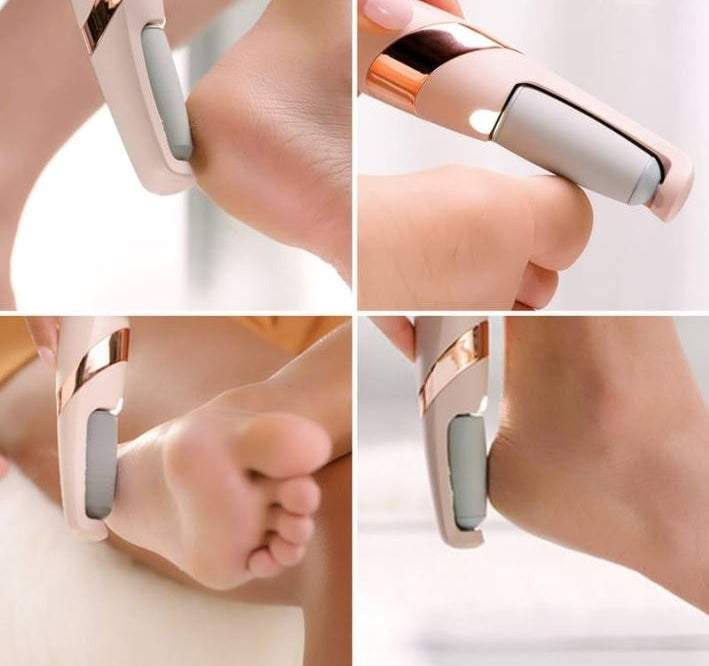 Electric Callus Remover
