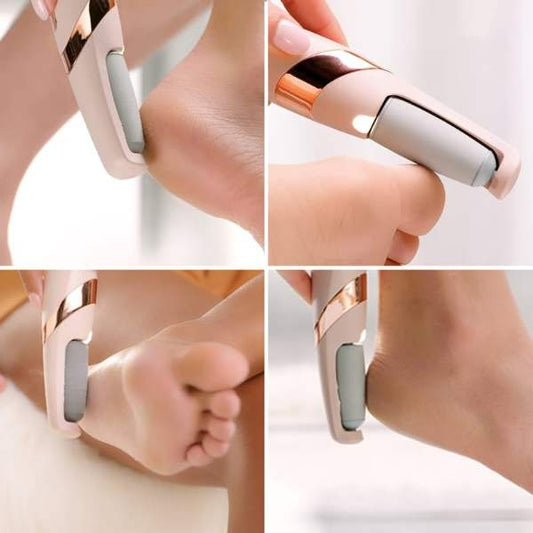 Electric Callus Remover